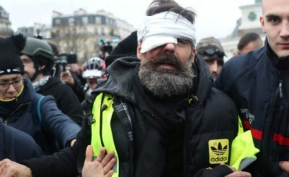 Jérôme Rodrigues : figure des Gilets jaunes, blessé à l'oeil