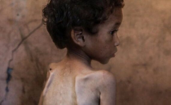 Directeur de l'hôpital Nasser à Khan Yunis, Dr Ahmed Al-Farra