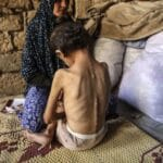 Les prisonniers israéliens amaigris sont les conséquences de la famine imposée par Netanyahou et sa bande Les prisonniers israéliens amaigris sont les conséquences de la famine imposée par Netanyahou et sa bande